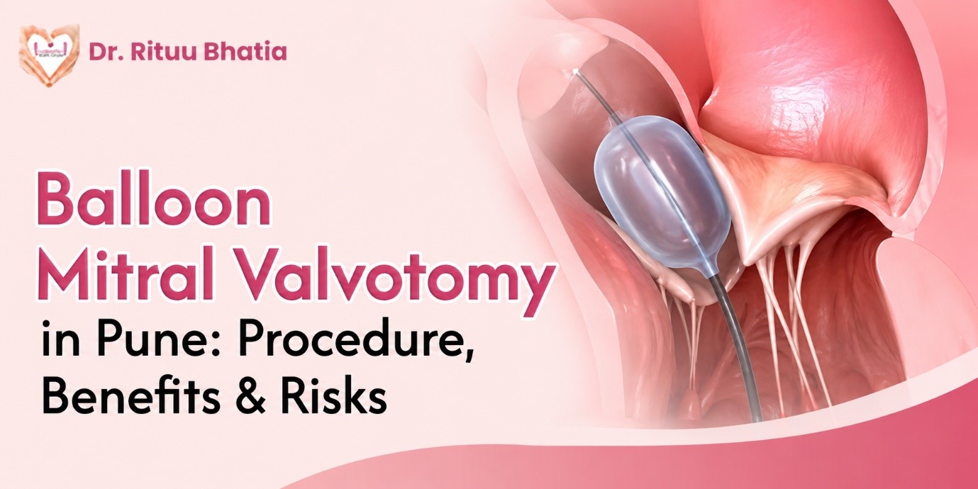 Balloon Mitral Valvotomy in Pune