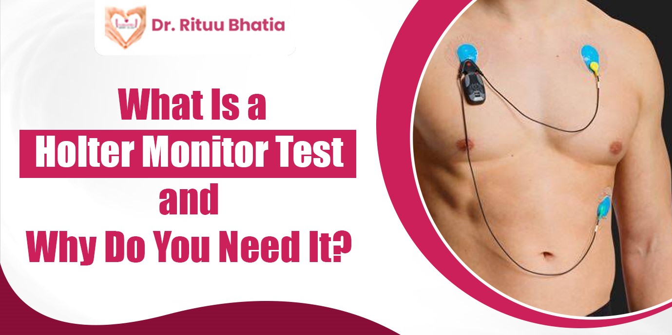 Holter Monitor Test