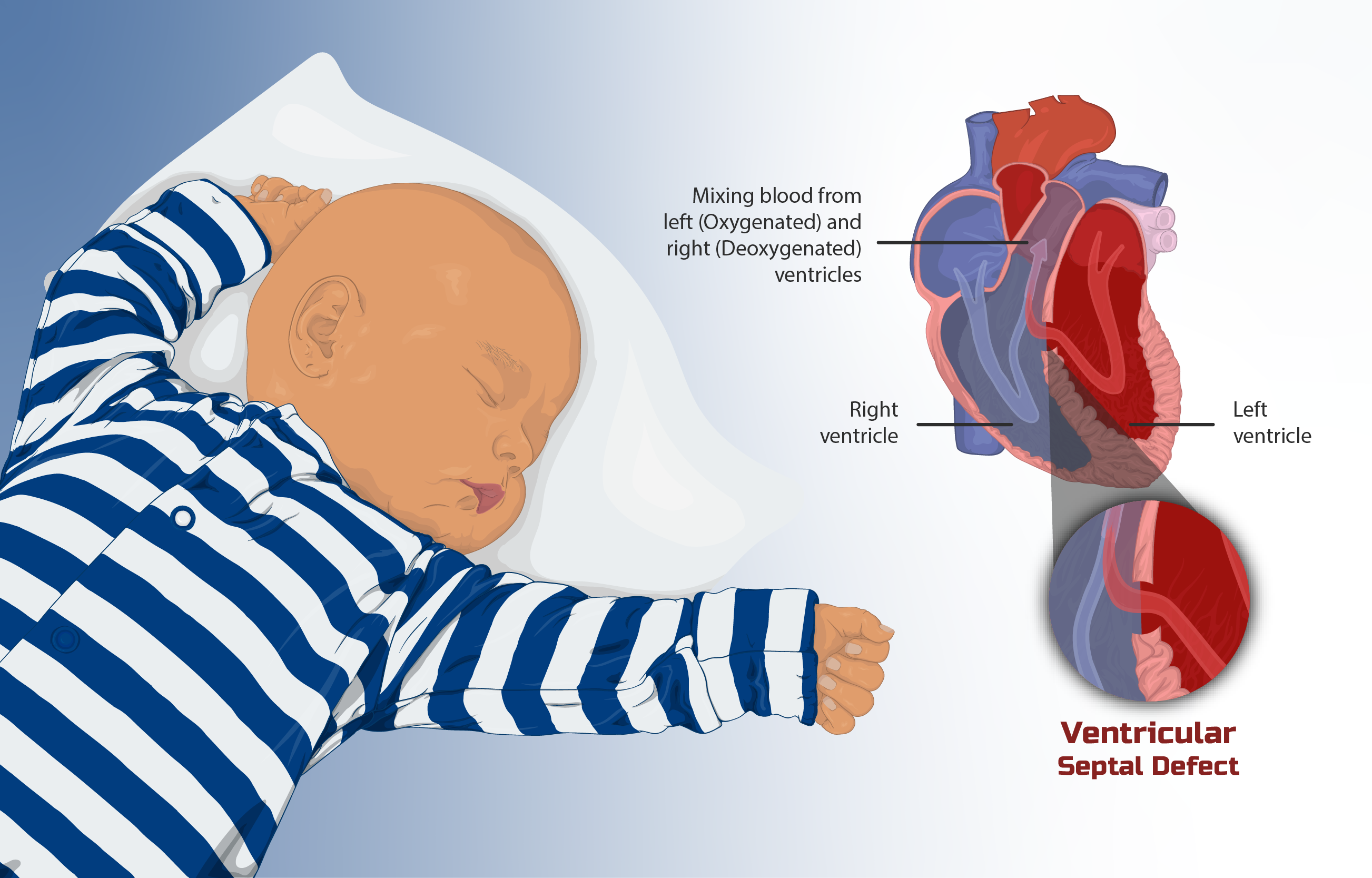 Valve Disease in Pune