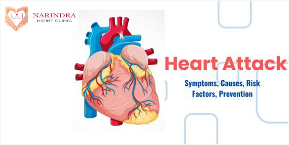 angioplasty surgery